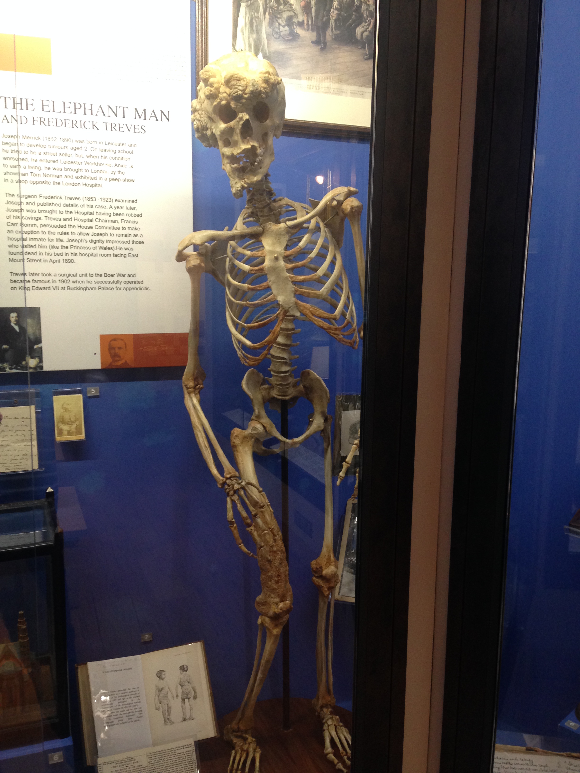 Royal London Hospital | Mi blog de aventuras | 2016